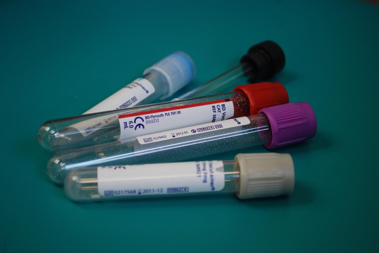 Penyebab Utama Acne Vulgaris