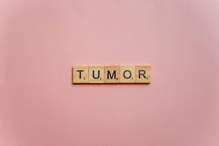 Mengenal Tumor Parotis: Tanda, Penyebab, dan Solusi Pengobatan yang Efektif