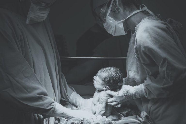 Kenali Penyebab Kepala Bayi Lonjong dan Cara Tepat Mengatasinya